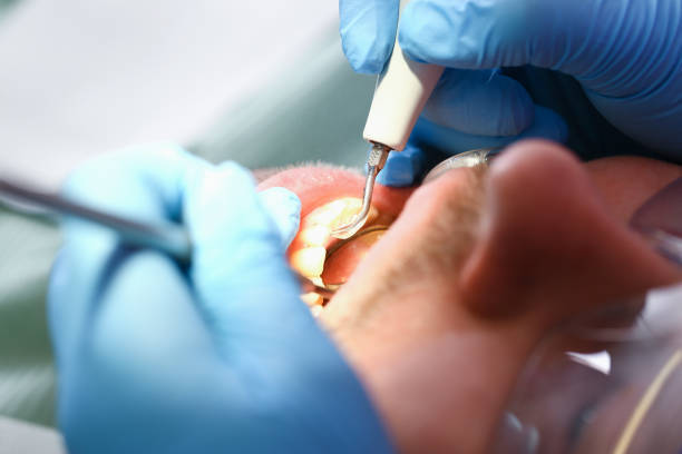 Best Mobile Emergency Dentist in Lawton, MI