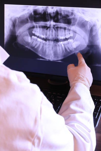 Best Emergency Root Canal Treatment in Lawton, MI