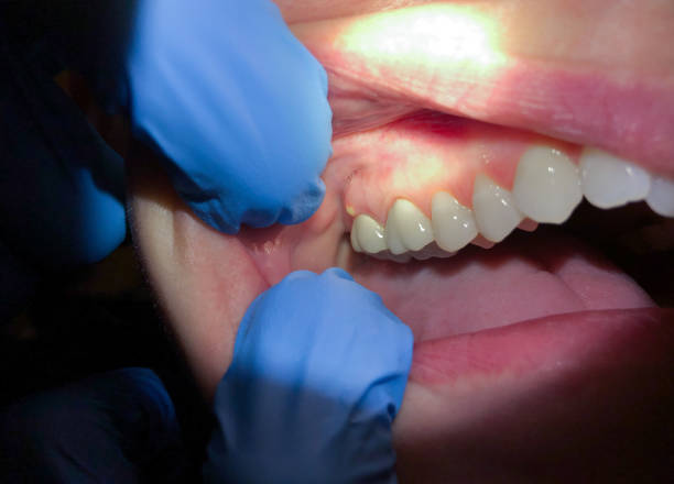 Best Urgent Dental Care for Toothache in Lawton, MI