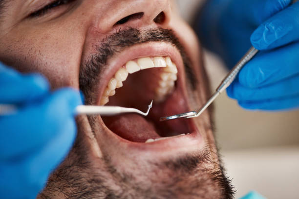 Best Emergency Dental Services for Seniors in Lawton, MI
