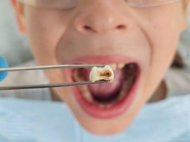 Best Emergency Dental Services for Seniors in Lawton, MI
